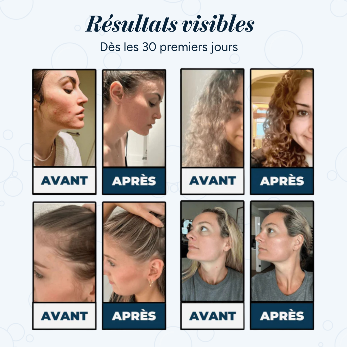 HydroShower [Kit filtre de douche]