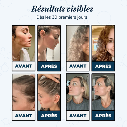 HydroShower [Kit filtre de douche]